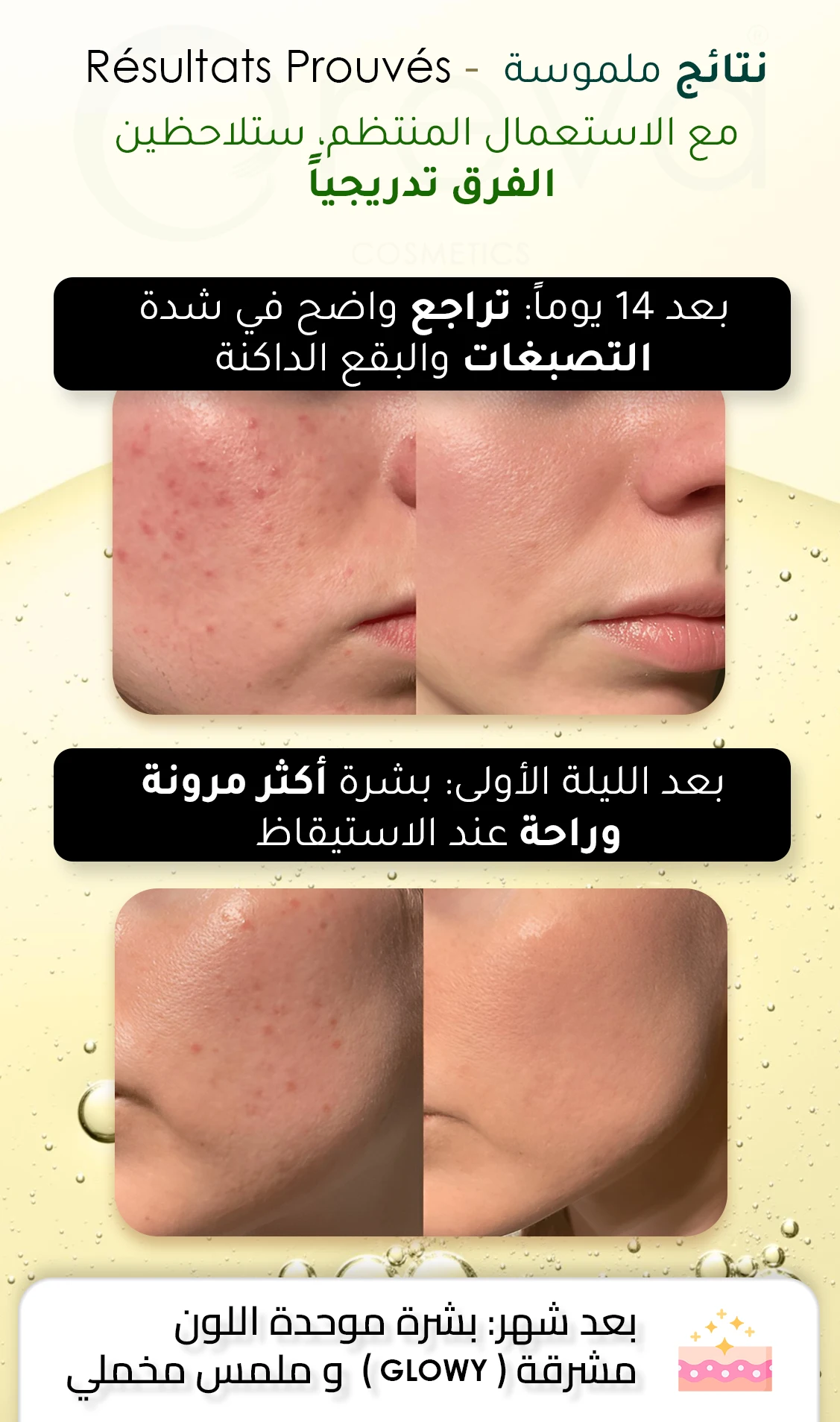 Landing Page Serum 5